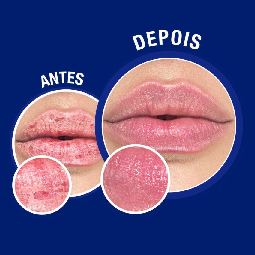 Neutrogena Bálsamo Nariz e Lábios Reparação Intensa 15 ml